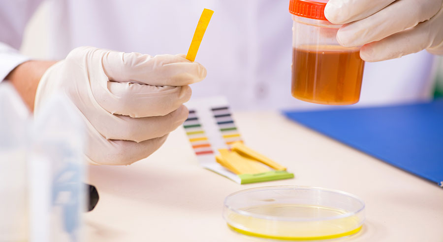 Phenolphthalein-Application