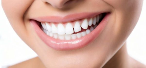 Hydroxyapatite-prevent-dental-caries